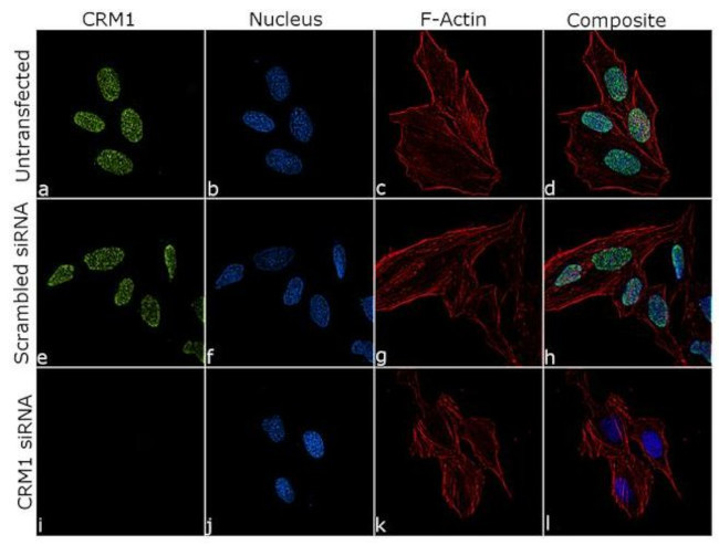 CRM1 Antibody in Immunocytochemistry (ICC/IF)