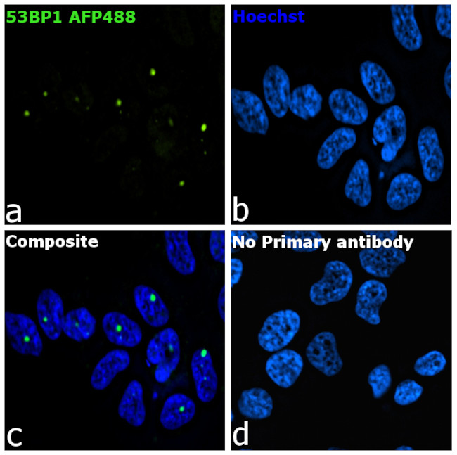 53BP1 Antibody in Immunocytochemistry (ICC/IF)