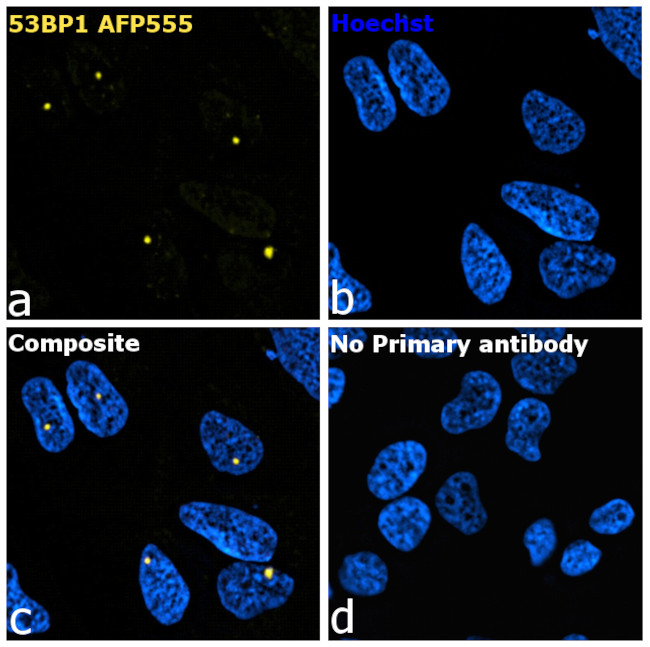 53BP1 Antibody in Immunocytochemistry (ICC/IF)