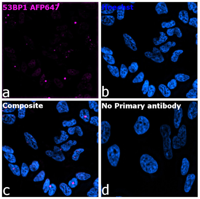 53BP1 Antibody in Immunocytochemistry (ICC/IF)