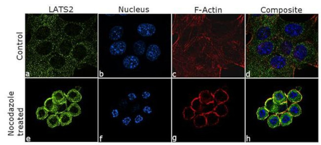 LATS2 Antibody in Immunocytochemistry (ICC/IF)