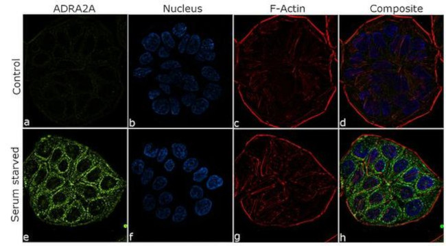 Alpha-2a Adrenergic Receptor Antibody in Immunocytochemistry (ICC/IF)