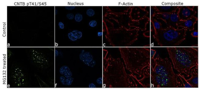 Phospho-beta Catenin (Thr41, Ser45) Antibody in Immunocytochemistry (ICC/IF)