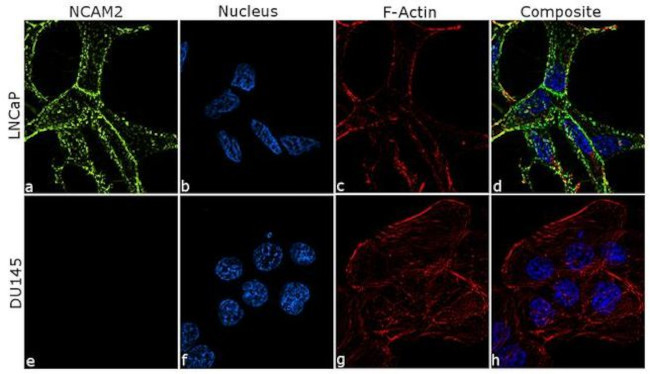 NCAM2 Antibody in Immunocytochemistry (ICC/IF)