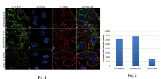 GPIP137 Antibody in Immunocytochemistry (ICC/IF)