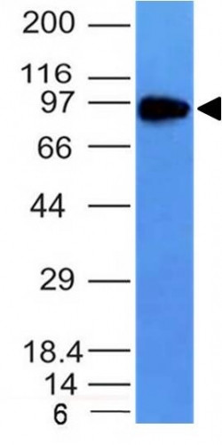 CD71/Transferrin Receptor (TFRC) Antibody in Western Blot (WB)