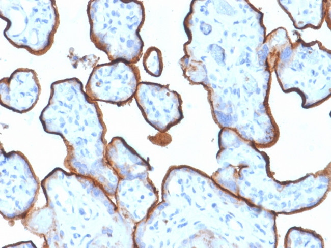 CD71/Transferrin Receptor (TFRC) (Extracellular Domain) Antibody in Immunohistochemistry (Paraffin) (IHC (P))