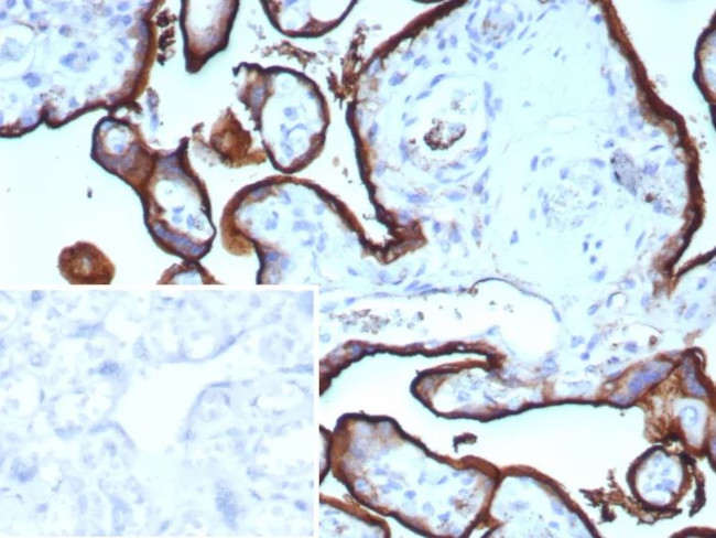 CD71/Transferrin Receptor (TFRC) (Extracellular Domain) Antibody in Immunohistochemistry (Paraffin) (IHC (P))