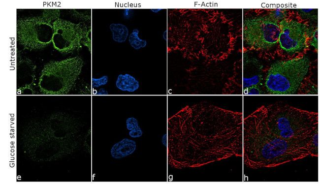 PKM2 Antibody in Immunocytochemistry (ICC/IF)