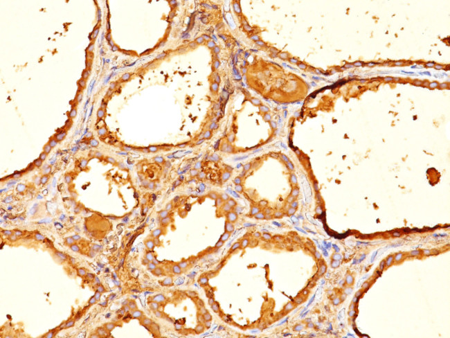 Thyroglobulin (Thyroidal Cell Marker) Antibody in Immunohistochemistry (Paraffin) (IHC (P))