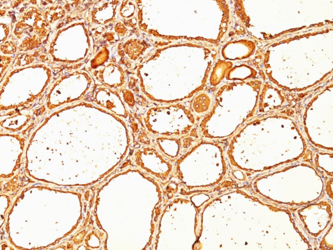 Thyroglobulin (Thyroidal Cell Marker) Antibody in Immunohistochemistry (Paraffin) (IHC (P))