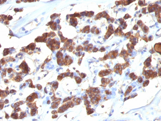 Thyroglobulin (Thyroidal Cell Marker) Antibody in Immunohistochemistry (Paraffin) (IHC (P))