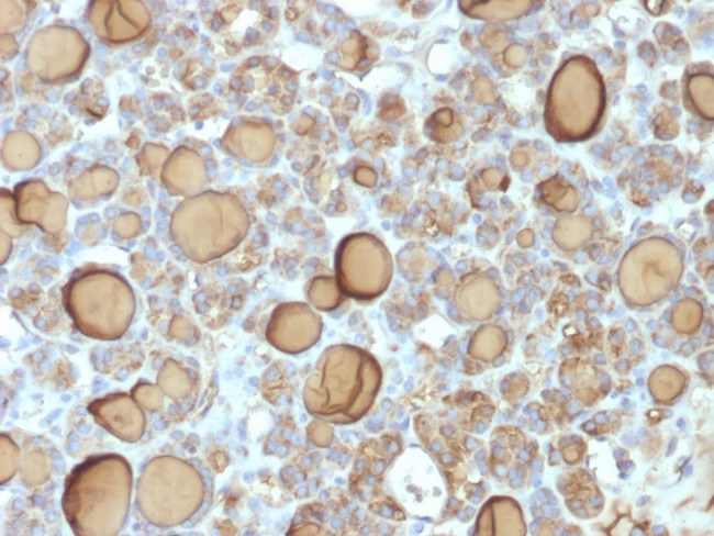Thyroglobulin Antibody in Immunohistochemistry (Paraffin) (IHC (P))
