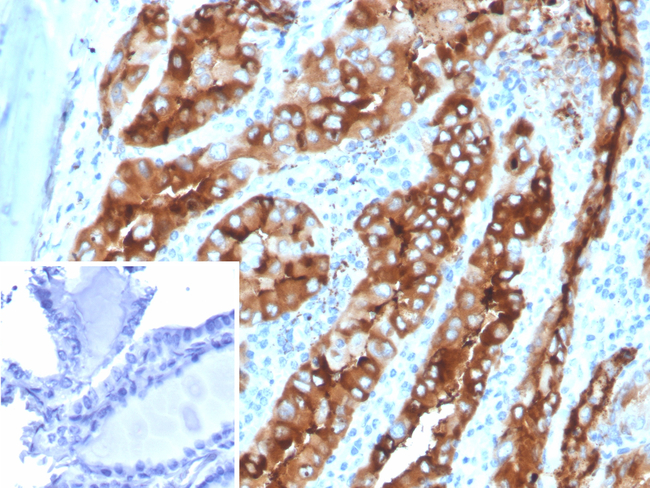 Thyroglobulin (Thyroidal Cell Marker) Antibody in Immunohistochemistry (Paraffin) (IHC (P))