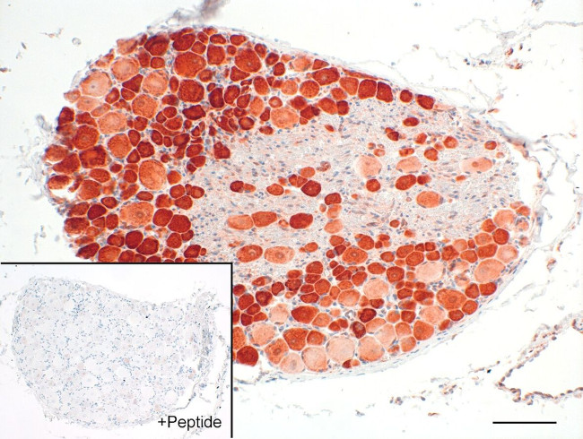 CALCRL Antibody in Immunohistochemistry (IHC)