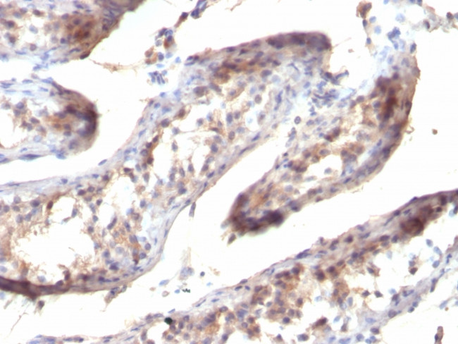 TGF-alpha (Transforming Growth Factor alpha) Antibody in Immunohistochemistry (Paraffin) (IHC (P))
