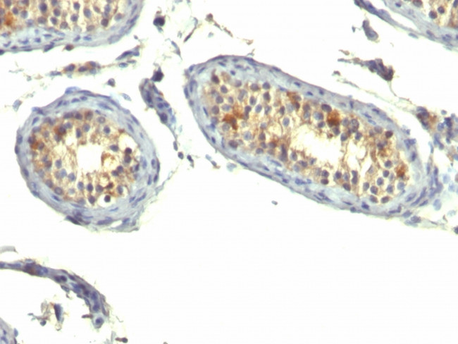 TGF-alpha (Transforming Growth Factor alpha) Antibody in Immunohistochemistry (Paraffin) (IHC (P))