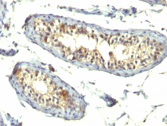 TGF-alpha (Transforming Growth Factor alpha) Antibody in Immunohistochemistry (Paraffin) (IHC (P))