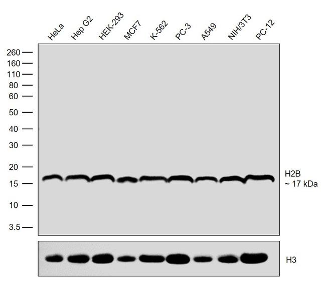 Histone H2B Antibody in Western Blot (WB)