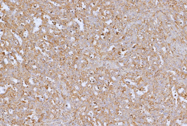 Transforming Growth Factor Beta Receptor 1 (TGFBR1) Antibody in Immunohistochemistry (Paraffin) (IHC (P))