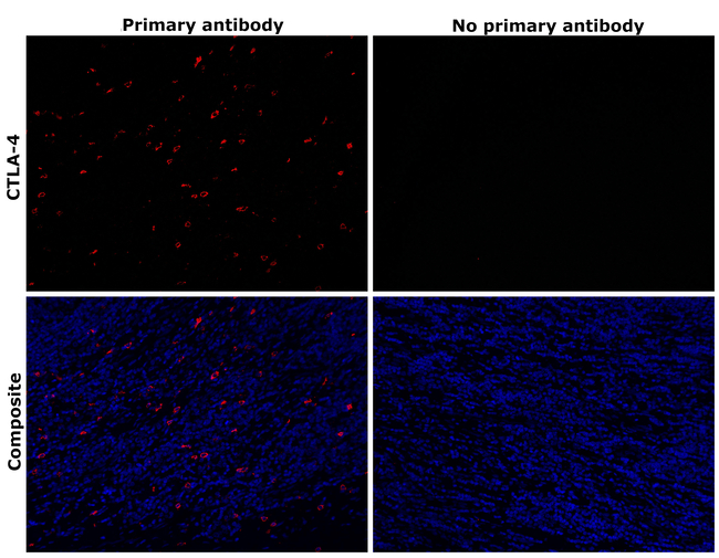 CTLA-4 Antibody in Immunohistochemistry (Paraffin) (IHC (P))