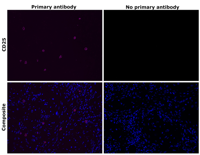 CD25 Antibody in Immunohistochemistry (Paraffin) (IHC (P))