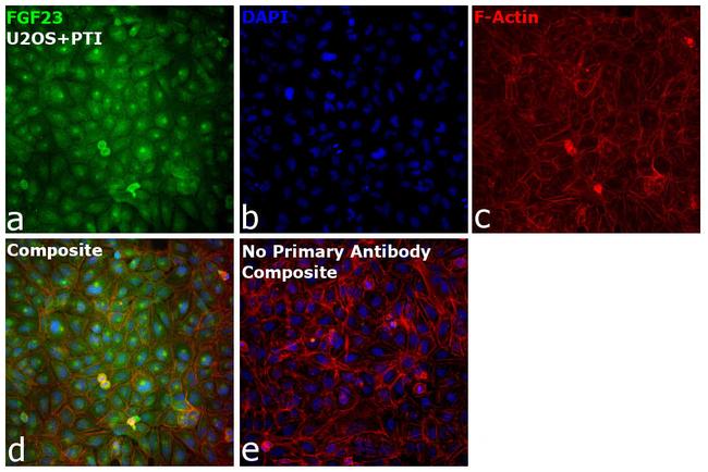 FGF23 Antibody in Immunocytochemistry (ICC/IF)