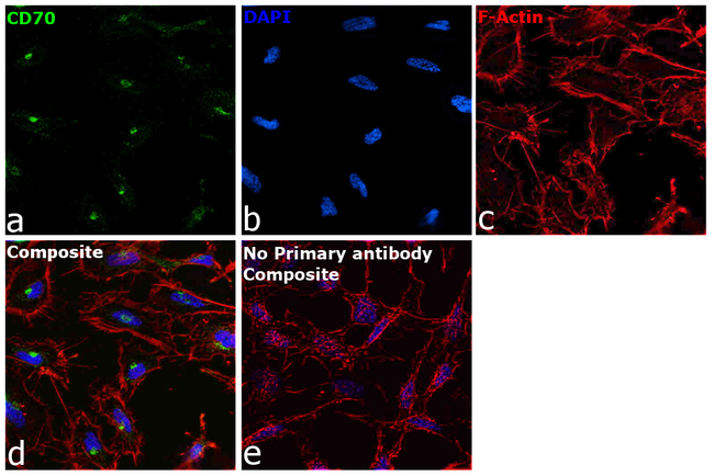 CD70 Antibody in Immunocytochemistry (ICC/IF)