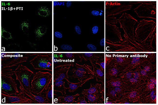 IL-6 Antibody in Immunocytochemistry (ICC/IF)