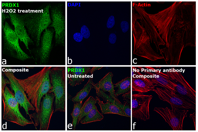 PRDX1 Antibody in Immunocytochemistry (ICC/IF)