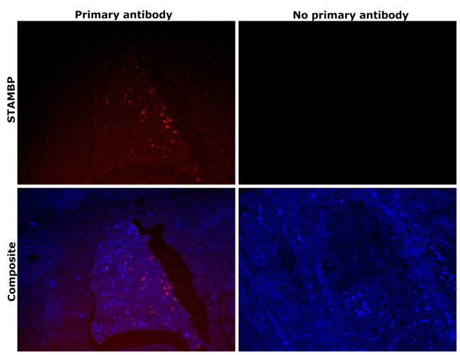 STAMBP Antibody in Immunohistochemistry (Paraffin) (IHC (P))