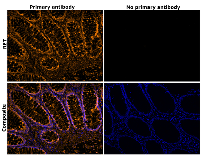 RET Antibody in Immunohistochemistry (Paraffin) (IHC (P))