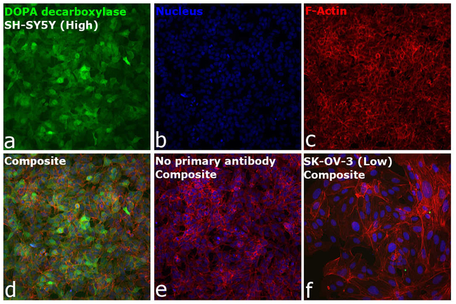 DOPA decarboxylase Antibody in Immunocytochemistry (ICC/IF)