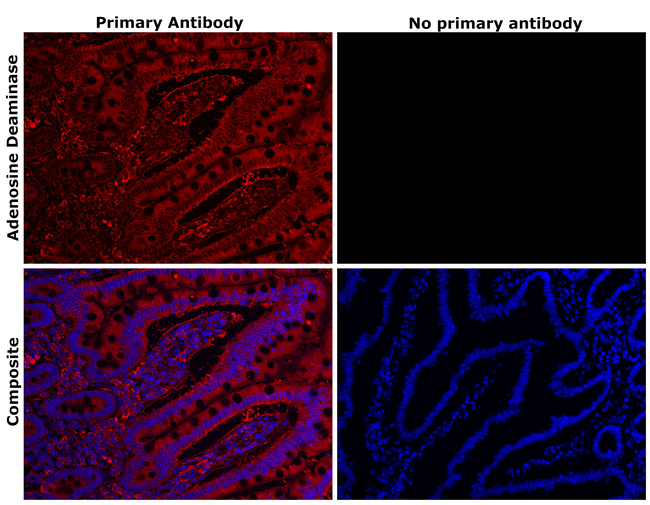 Adenosine Deaminase Antibody in Immunohistochemistry (Paraffin) (IHC (P))