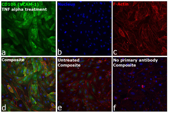 CD106 (VCAM-1) Antibody in Immunocytochemistry (ICC/IF)