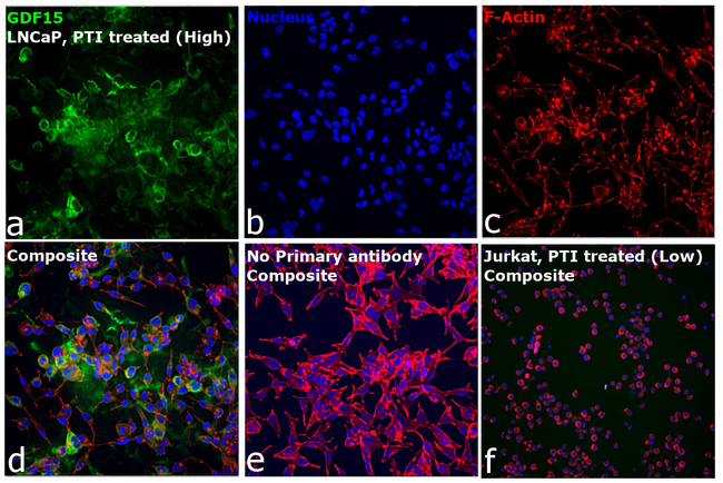 GDF15 Antibody in Immunocytochemistry (ICC/IF)