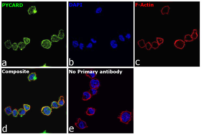 PYCARD Antibody in Immunocytochemistry (ICC/IF)