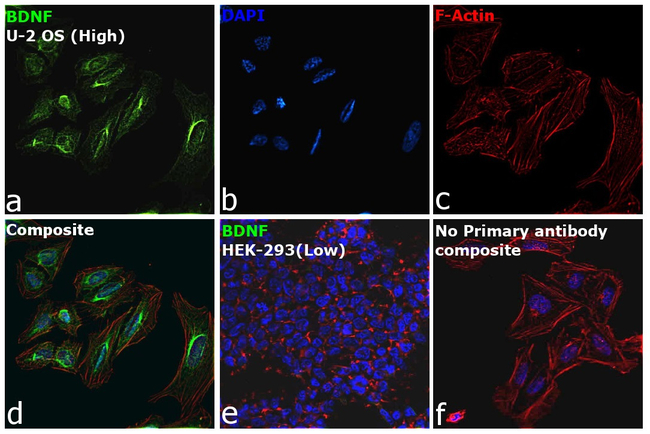 BDNF Antibody in Immunocytochemistry (ICC/IF)