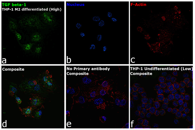 TGF beta-1 Antibody in Immunocytochemistry (ICC/IF)