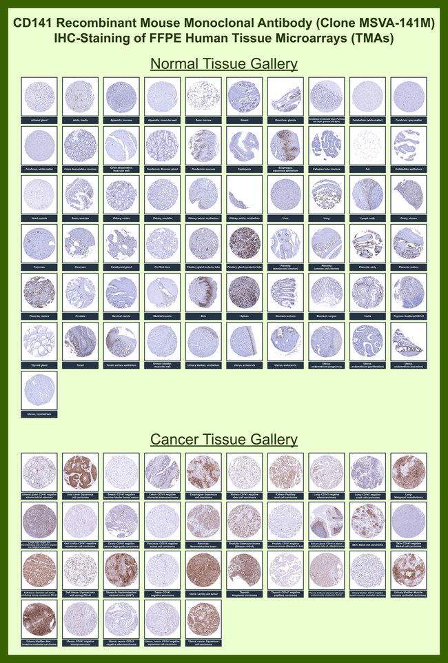 Thrombomodulin/CD141 (Endothelial Cell Marker) Antibody in Immunohistochemistry (Paraffin) (IHC (P))