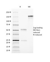 CD90/Thy1 (Mesenchymal Cell Marker) Antibody in SDS-PAGE (SDS-PAGE)