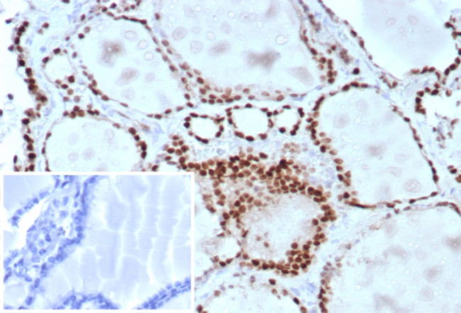 TTF-1/NKX2.1 (Thyroid and Lung Epithelial Marker) Antibody in Immunohistochemistry (Paraffin) (IHC (P))