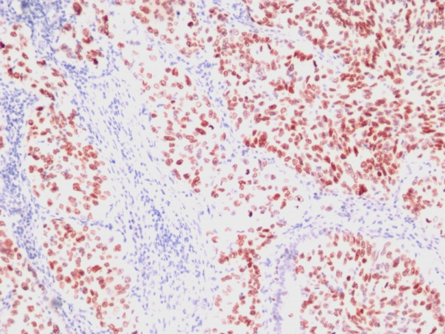 TTF-1/NKX2.1 (Thyroid and Lung Epithelial Marker) Antibody in Immunohistochemistry (Paraffin) (IHC (P))