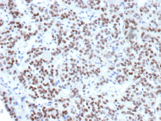 TTF-1/NKX2.1 (Thyroid and Lung Epithelial Marker) Antibody in Immunohistochemistry (Paraffin) (IHC (P))