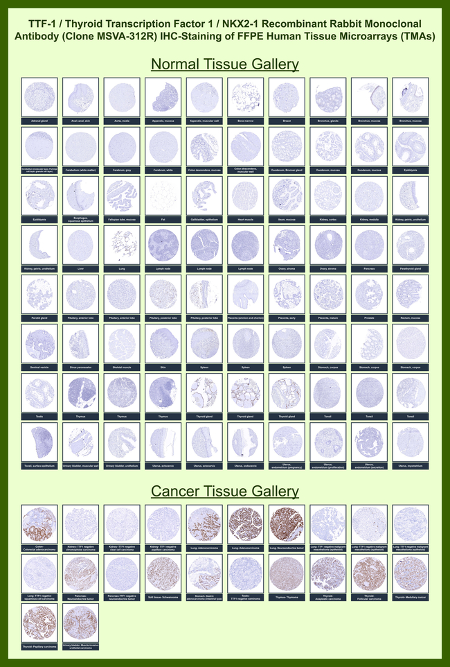 TTF-1/NKX2.1 (Thyroid & Lung Epithelial Marker) Antibody in Immunohistochemistry (Paraffin) (IHC (P))