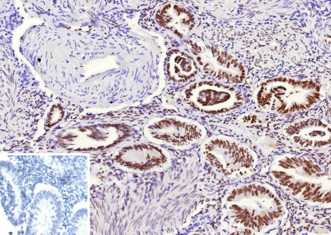 TLE1 (Synovial Sarcoma Marker) Antibody in Immunohistochemistry (Paraffin) (IHC (P))