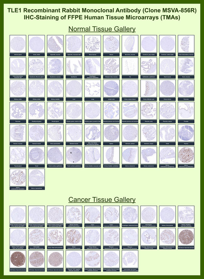 TLE1 (Synovial Sarcoma Marker) Antibody in Immunohistochemistry (Paraffin) (IHC (P))