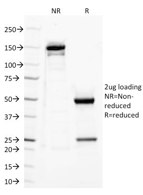 CD282 (Toll-Like Receptor 2) Antibody in SDS-PAGE (SDS-PAGE)