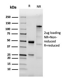 CD282 (Toll-Like Receptor 2) Antibody in SDS-PAGE (SDS-PAGE)