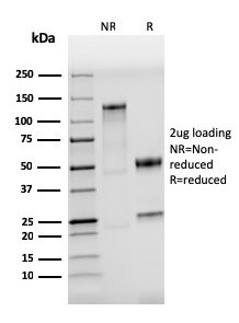 CD284 (Toll-Like Receptor 4) Antibody in SDS-PAGE (SDS-PAGE)